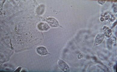 Trichomonade observé au microscope